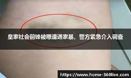 皇家社会前锋被曝遭遇家暴，警方紧急介入调查
